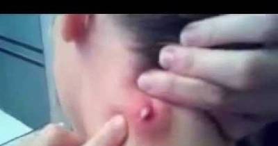 His Girlfriend Felt Something VERY STRANGE... But When She Popped It... OMG It Wouldn&rsquo;t Stop. . .