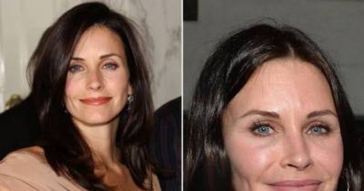 Pretty Actresses Who Ruined Their Face With Botox