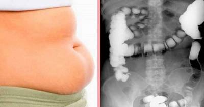 Completely Remove All The Swelling Of Your Belly In Just 10 Minutes. Hard To Believe, But True.