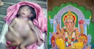 Shocking: Newborn Baby With Eight Limbs Worshipped As &lsquo;Hindu God&rsquo; In India