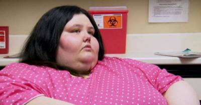 She Lost An Incredible 537 Pounds, But What Happened Afterward Will Shock You...