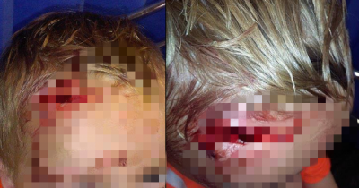 Child Falls And Cuts His Head Then Needs 12 Stitches... Then The Hospital Did This ? Horrifying