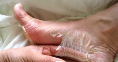 Nightmares For Anyone Who Hates Feet