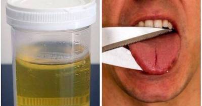 14 Very Unfortunate Medical Treatments That Actually Used To Exist