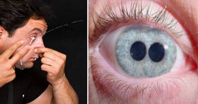 Bizarre Eyes You Can't Unsee