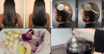 She Had Very Thin Hair But She Used This Ingredient And Got Thick Hair Within A Week