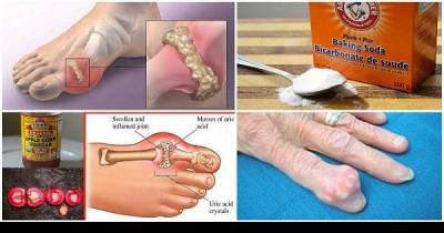 Try This Next Time To Prevent Gout And Joint Pain