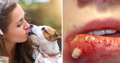This Is Why You Should Never Let Your Dog Lick You!