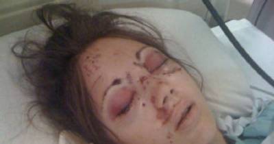 She Did One Thing When She Got In The Car. Now She's Trying To Warn Others Of The Danger