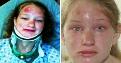 Mom Blames Game After 15 Year Old Playing Pok&eacute;mon Go Is Hit By Car