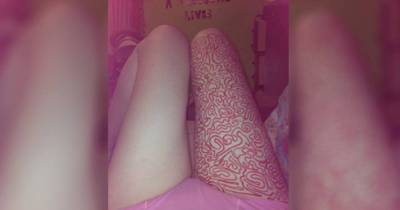 A Young Woman Posted These Striking Images Online. When I found Out What Really It Is, I Cried.