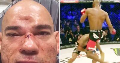Cyborg Reveals Gruesome X-Ray After Getting Skull Crushed In By Michael Page