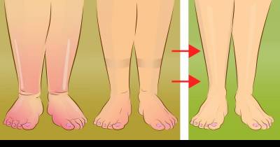 Try This All-Natural Way Of Getting Rid Of Water Retention In Your Body