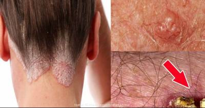 Cancer Symptoms Women Often Ignore - Must Read