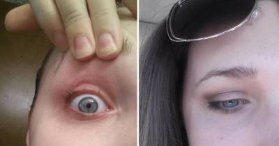 This Woman's Eyelash Curler Disaster Is Straight From Your Nightmares