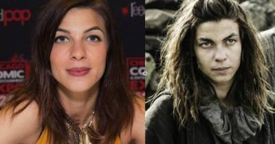 15 Ugly Game of Thrones Characters Who Are Good Looking In Real Life