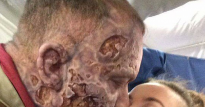 This Is What The Mountain&rsquo;s Face From &ldquo;Game Of Thrones&rdquo; Actually Looks Like Under That Helmet Btw
