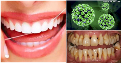 One Or More Of These 12 Horrific Things That Will Happen To You When You Fail To Brush Your Teeth