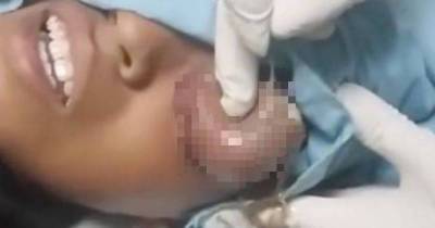 Gruesome Moment Doctor Pops Giant Cyst Which Completely Covers Little Boy's Eye