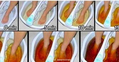 This Is What Flushing Toxins Out Of Your Body Looks Like, And It's Disgusting