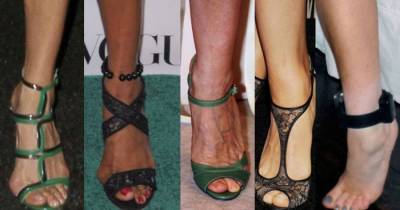 15 Celebrities With Ugly Feet