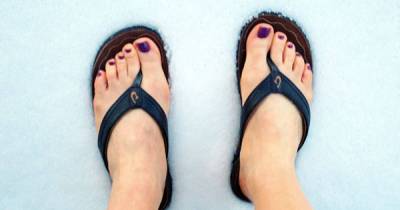 Doctors Warn: Don&rsquo;t Wear Flip Flops For This Dangerous Reason!