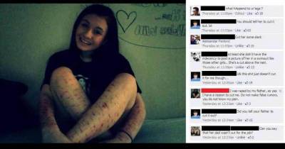 Girl Posts Picture On Facebook Of &ldquo;Cutting&rdquo; And Gets Endlessly Trolled By Cyberbullies.