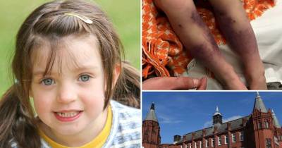 This 4 Year Old Nearly Loses Her Legs Because Of Chickenpox