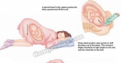 Proper Sleeping Positions During Pregnancy That You Should Know