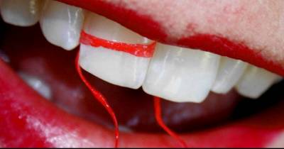 Everything We&rsquo;ve Been Told About Flossing May Have Been a Lie