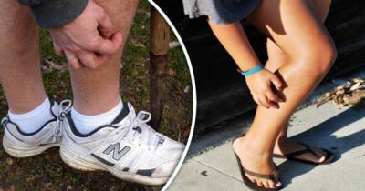 The Many Annoying Causes Of Aggravating Itchy Legs