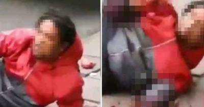'Thief' Has Hand Chopped Off By 'Machete-Wielding Shopkeeper'