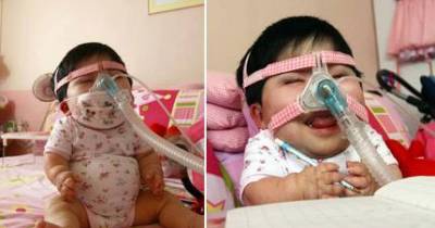 17 Year Old Girl With A Rare Disease Lives In A Baby's Body