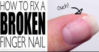 You Can Fix Your Broken Finger Nail With These Simple Steps