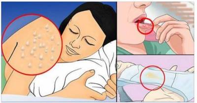 These Health Signs Indicate That You Might Have HIV/AIDS