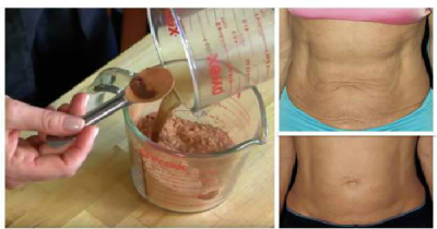 Powerful Natural Mask Made With Clay, Tea And Other Home Ingredients Tightens Saggy Stomach Skin At Home Without Expensive Spa Treatments!