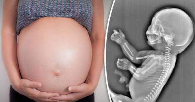 Young Mum 'Terminates "Mermaid" Pregnancy At 6 Months After Discovering Child Had Grown Tail'