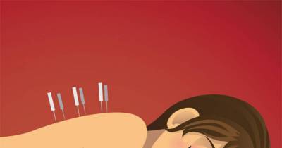 Fantastic Reasons To Try Acupuncture!