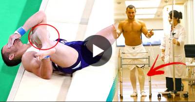 French Gymnast Who Snapped His Leg Is Walking ALREADY