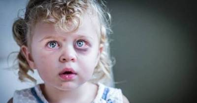 Little Girl's 911 Call Sends Important Message About Domestic Violence