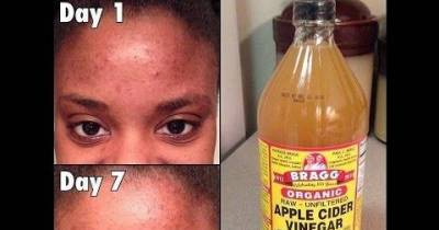 16 Uses For Vinegar You Didn&rsquo;t Know About!