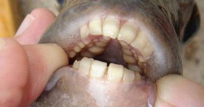 Fish With Human-Like Teeth And A Taste For Testicles Found In Popular US Lake