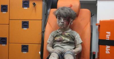 This Is The Real Story Behind The Picture Of The Bleeding Syrian Boy