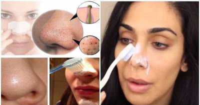 How To Clear Blackheads With Toothpaste
