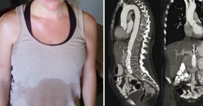 If You Sweat A lot, Your Body May Be Trying To Tell You Something Important