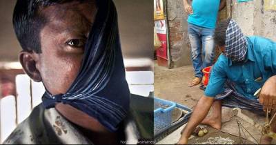 20 Years After A Tiger Attack, He Finally Revealed His Face