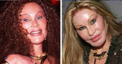 What Do You Really Know About The Bride Of Wildenstein?