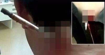 Horrific Video Shows Man With Spear Impaled Through His Neck After Terrible Fishing Accident