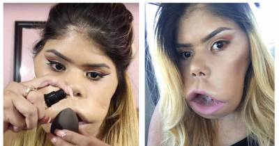 Meet This Inspirational Beauty Vlogger With Cystic Hygroma Who Proves That Self-Acceptance Is All That Matters!
