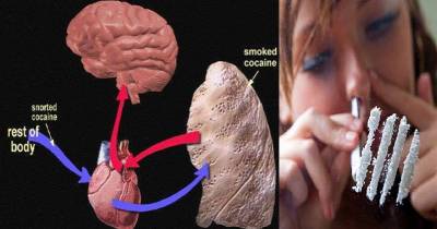 What Cocaine Can Do To A Human Heart Over Time Is Absolutely Insane